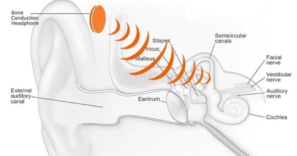 Apakah Headphone Bone Conduction Aman